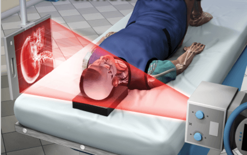 Adaptive Radiography: Tips and Tricks course image