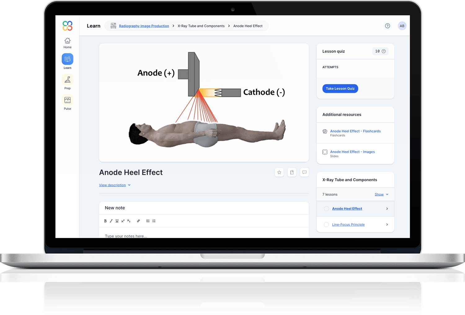 anode-video-macbook